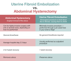 Uterine Fibroid Embolization Ufe Fairfax Radiological
