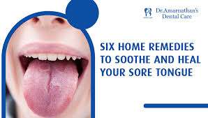 soothe and heal your sore tongue