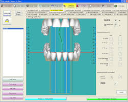 Tce Tmj Chart Large Screen View