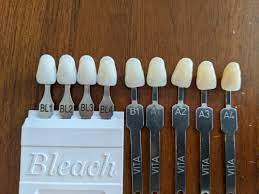 bl1 vs bl2 veneers color how white are