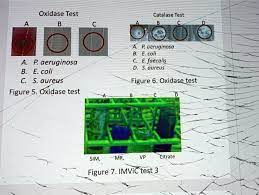 oxidase test catalase test pseudomonas