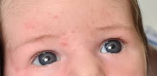 What age do infants recognize faces? Baby Eye Color How Did Yours Change Mumsnet