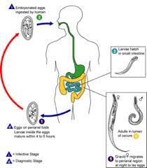 Naturally assist in the removal of pinworms, larvae, and the eggs. Pinworm Infection Wikipedia