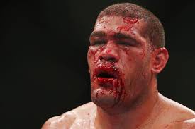 UFC Fight Night 33 Results: Antonio Silva Says Failed Test &#39;Was Not My Mistake - hi-res-454073215-antonio-big-foot-silva-of-brazil-looks-on-in-his_crop_north