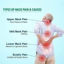 We did not find results for: Back Pain Is Increasingly Becoming A Major Health Concern The Type Of Pain Areas Impacted Depend On The Nerves Affected Can Begin From The Upper Neck Region Go All