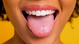 healthy tongue pictures conditions