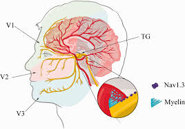 trigeminal neuralgia an overview from