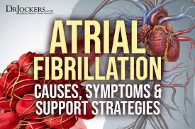 atrial fibrillation causes symptoms