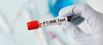 prothrombin time inr test purpose