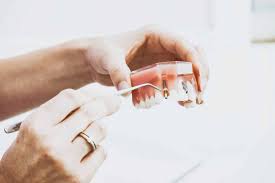 skilled dental implant specialists