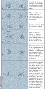 Pediatric Vision Screening For The Family Physician