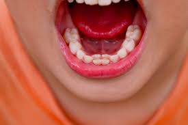 When Do Kids Get Their Permanent Teeth? | Learn More