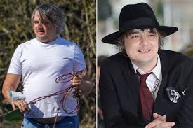 Pete doherty is writing a musical. Pete Doherty Says His Unrecognisable New Look Is Down To His Love Of Cheese On Toast Mirror Online