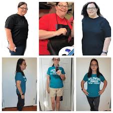 100 pounds after gastric sleeve surgery
