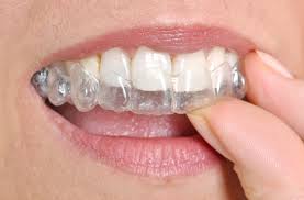 The splint stabilizes teeth so that they are less likely to move, which can weaken the teeth and cause them to fall out. 5 Types Of Dental Splints Know Their Functions Blog