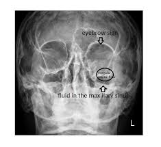 imaging case of the week 278 answer