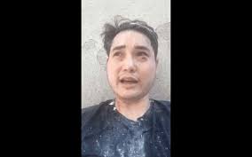 Before the event, around 50 protesters gathered. Conservative Journalist Andy Ngo Beaten Up And Hit With Cement By Antifa In Portland Says Police Did Nothing Pj Media