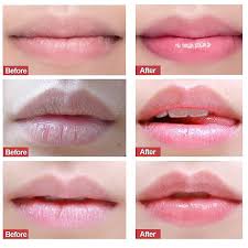 lip care scrub softens keratin removes