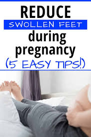 swollen feet during pregnancy