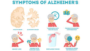 diagnosis of alzheimer s disease
