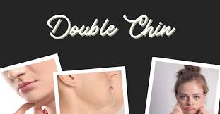 treatments to get rid of double chin
