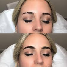 microblading dermaplaning lately
