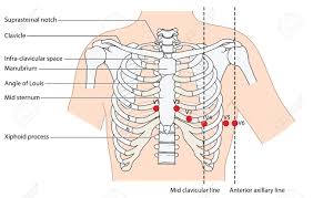 An exception to this rule is that the first rib articulates with the first thoracic vertebra only. Placement Of Ecg Ekg Leads Showing The Ribs And Sternum The Royalty Free Cliparts Vectors And Stock Illustration Image 46942949