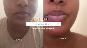 lighten lips with apple cider vinegar