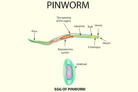 Pinworms During Pregnancy Causes Symptoms And Prevention