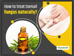 treat toenail fungus naturally