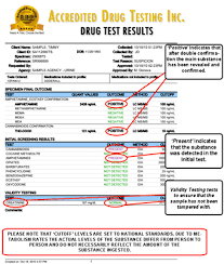Hair Follicle Test Results Levels Sbiroregon Org