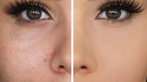 large pores make pores disappear
