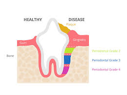 cat teeth and dental disease in hebron