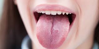 why is your tongue white doctors talk