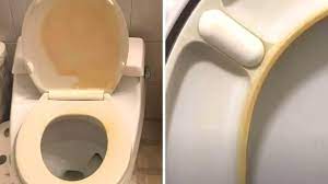 yellow stains from a toilet seat