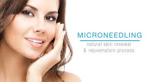 microneedling for anti aging at laser