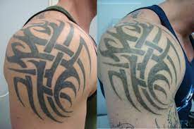 After i was saved, i was able to admit the real reason behind my desire for tattoos. What Will My Tattoo Look Like When I M 40 How Do Tattoos Age