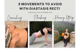 exercises with diastasis recti