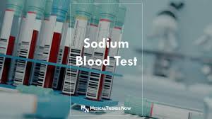 how to perform a blood sodium test