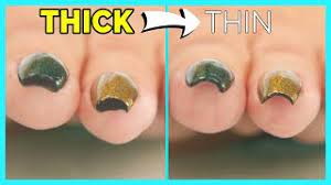 thick ugly nails quick hack to thin