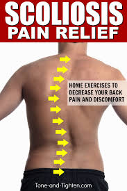 best exercises to treat scoliosis at home physical therapy exercises to help treat your back