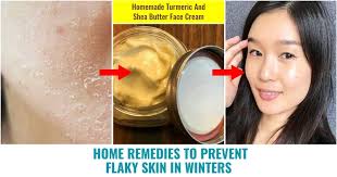 10 home remes to prevent flaky skin