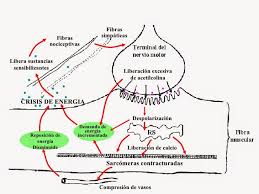 Resultado de imagen para punto gatillo