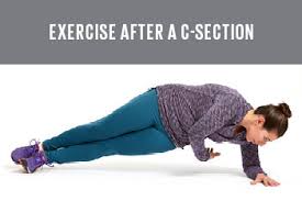 exercise after c section 5 safe moves