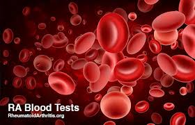 Ra Blood Tests What Lab Tests Show Rheumatoid Arthritis