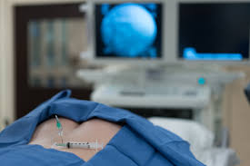 all about epidural steroid injections