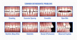 This is something that your dentist or. Common Orthodontic Problems