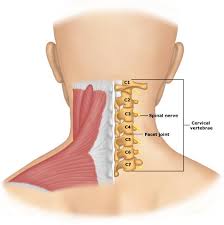 herniated disk neck surgery