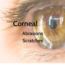 corneal scratches and abrasions signs