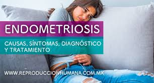 Endometriosis is characterised by the growth of endometrial tissue. Sintomas Diagnostico Y Tratamiento De La Endometriosis Reproduccion Humana
